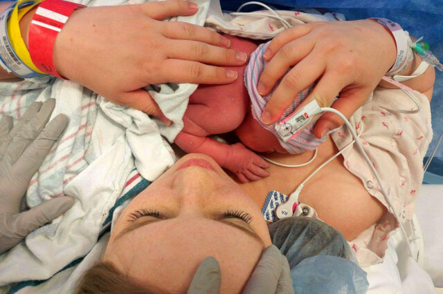 Mother with baby after C-section at UF Health North