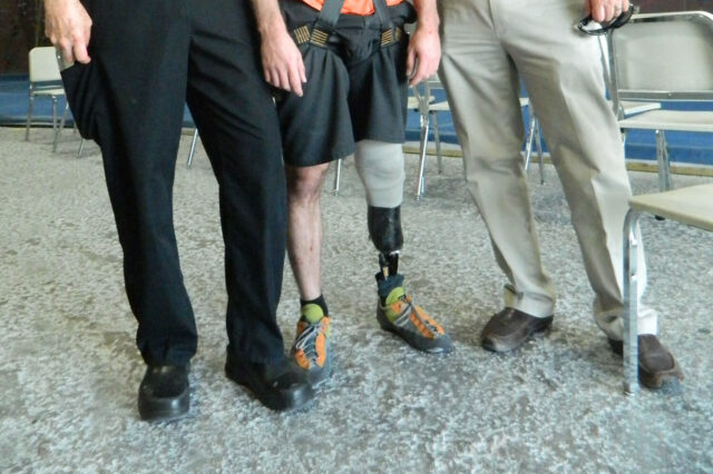 Stephen France posing with his prosthetic left leg.