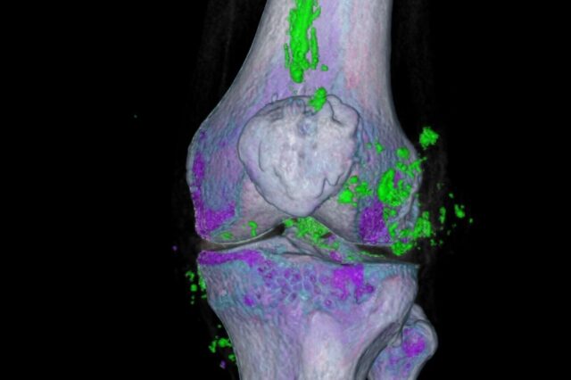 3D medical imaging of a knee joint